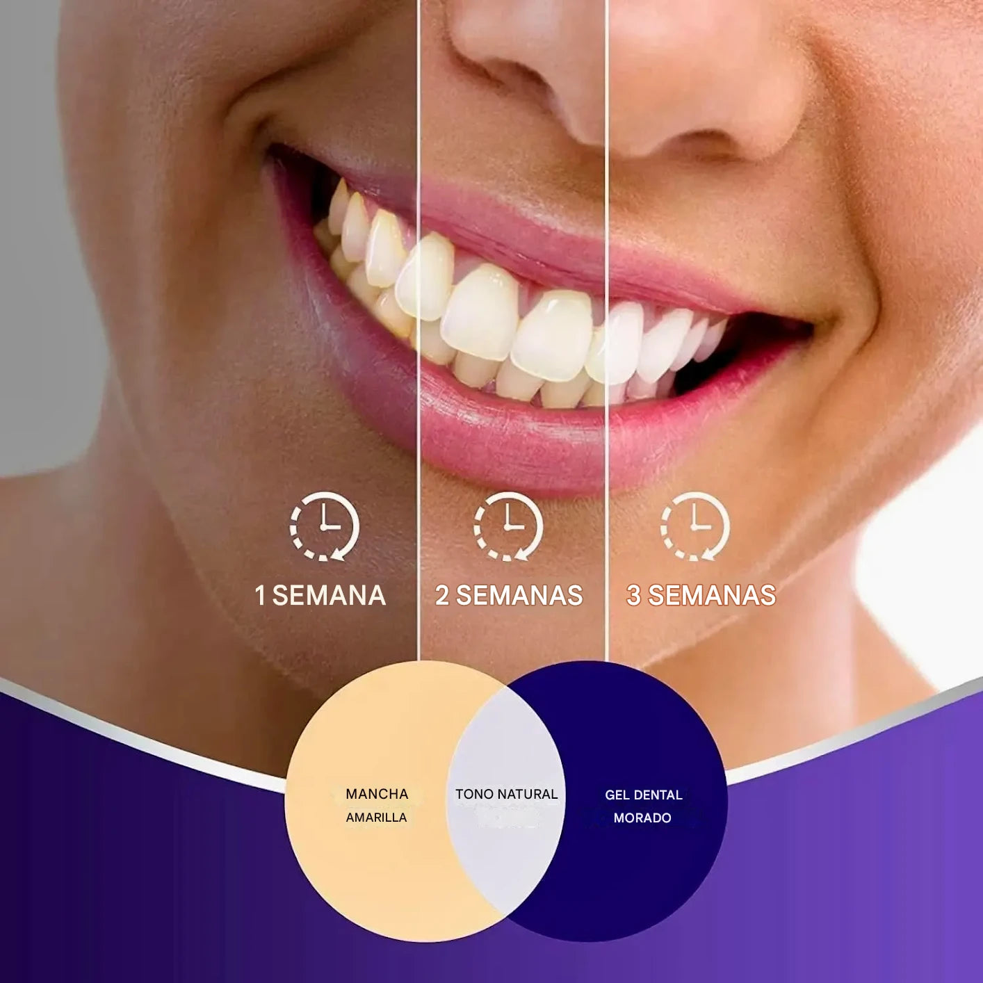 Espuma Blanqueadora Dental