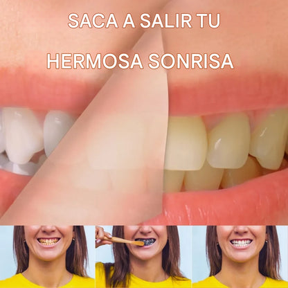 Espuma Blanqueadora  Dental