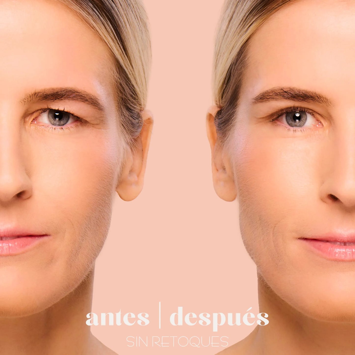 70 UNIDADES DE LEVANTA PARPADOS